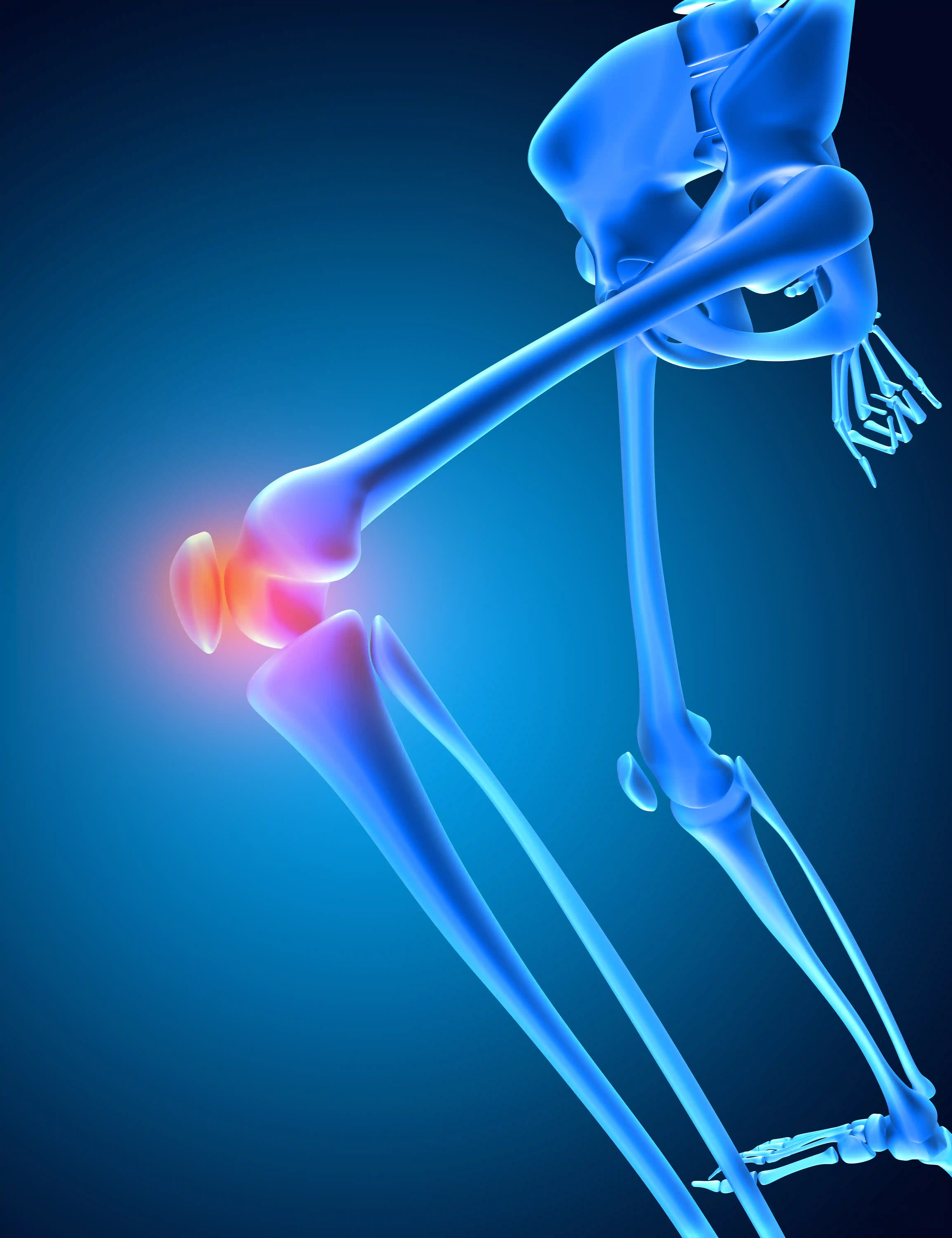ACL Reconstruction